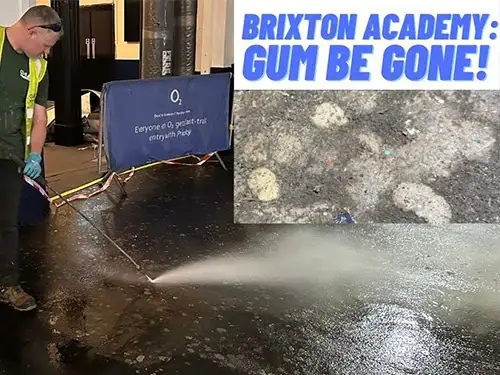 Gum Removal